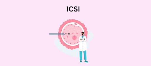 ICSI Treatment